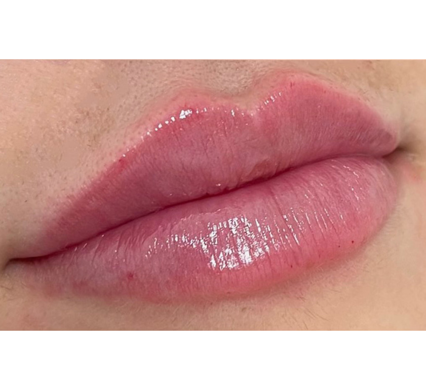 lip enhancement results 4